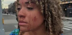 activista provida golpeada